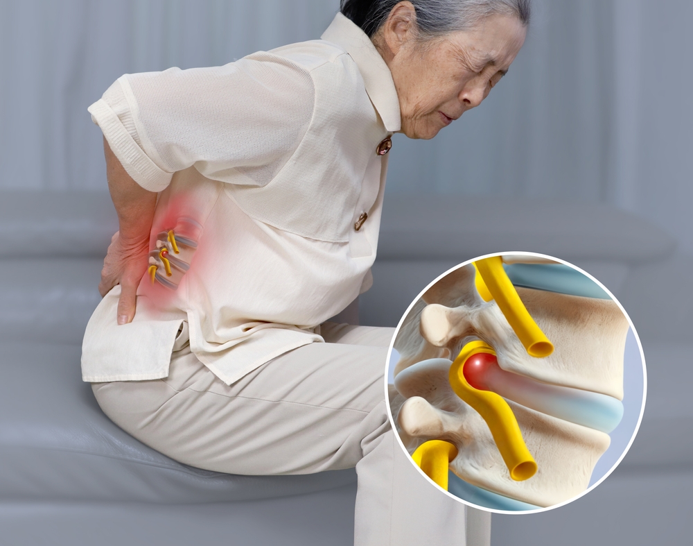 Herniated Disc Treatment